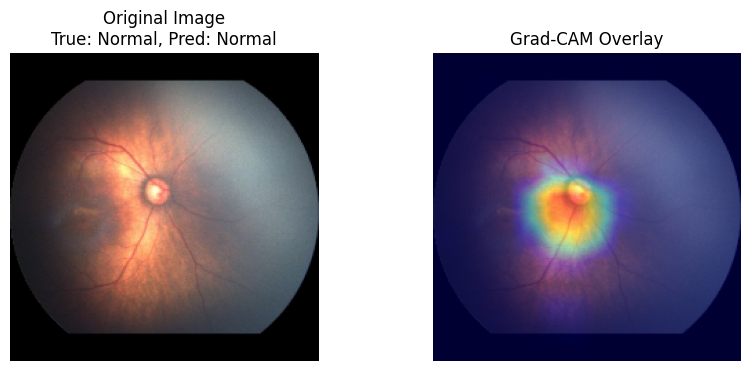 Grad-Cam visualization of DenseROPNet
